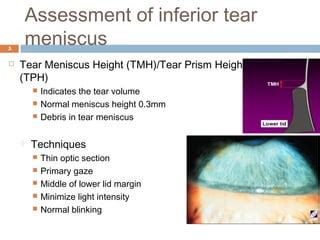 tear ferning test|tear meniscus height normal value.